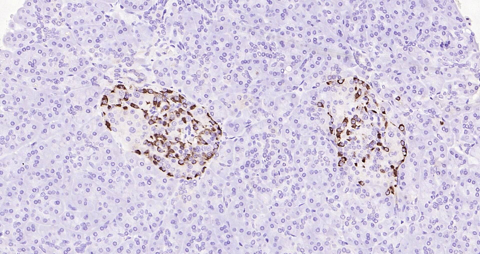 胰高血糖素即用型免疫组化试剂盒-IHC0104